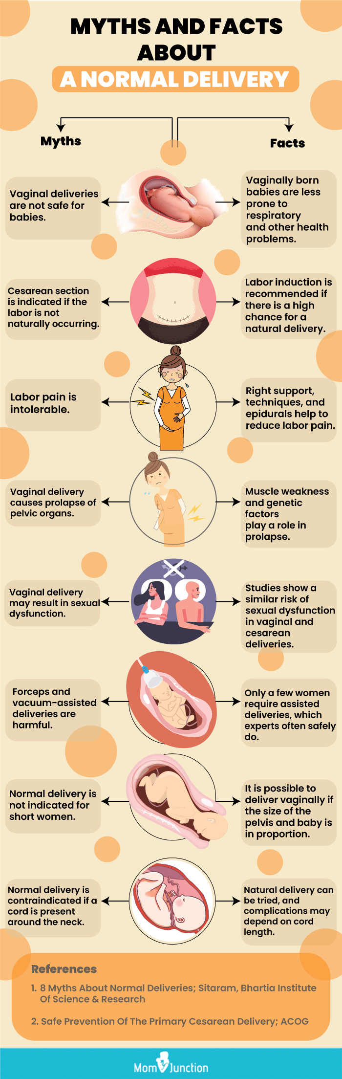 Ways To Induce Labor At 38 Weeks
